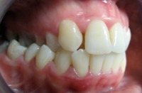 przykad ortodontyczny