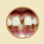 http://www.ortodonta.info/images/obj_szpara.jpg