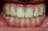 przykład ortodontyczny