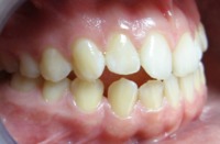 przykład ortodontyczny